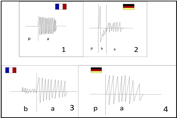 oscillogramme